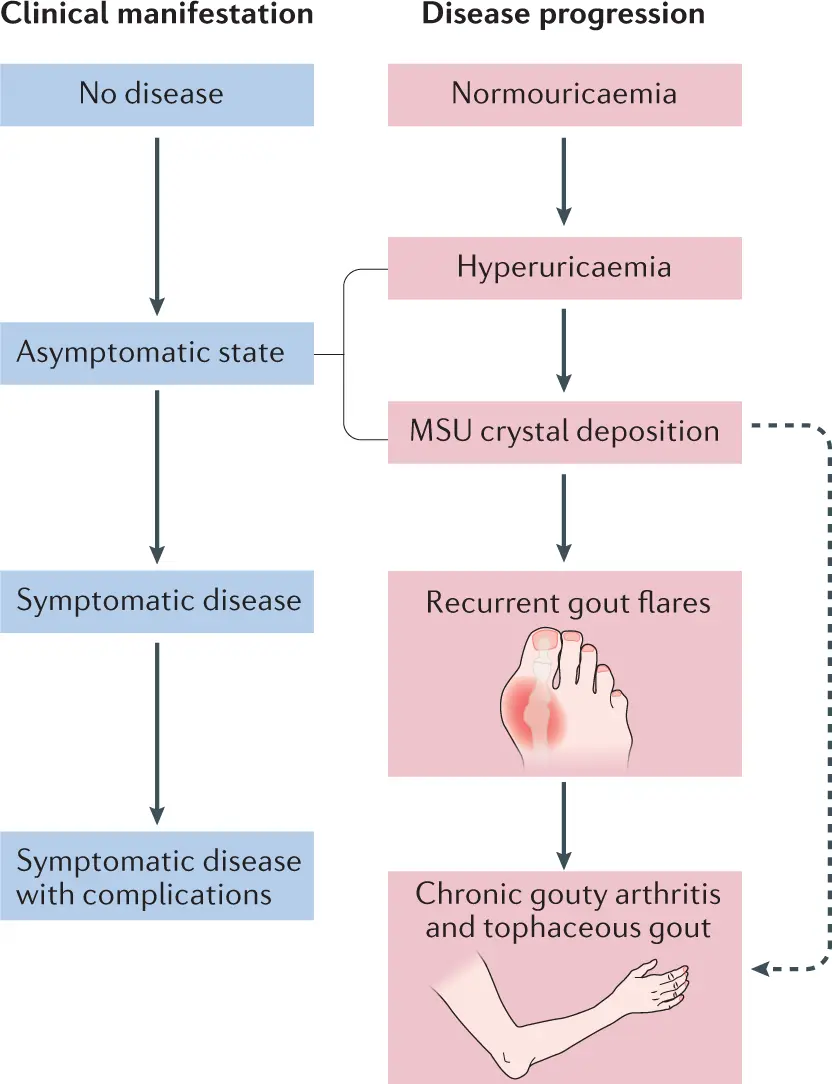 Symptoms of chronic kidney disease begin when it is too late. Simple research is enough