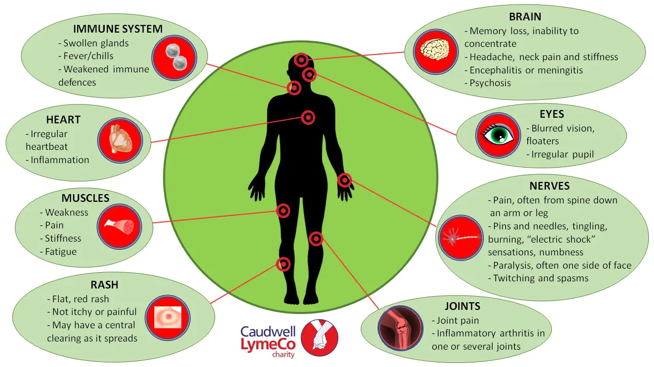 Symptoms of Lyme disease &#8211; cutaneous, neurological, joint and cardiac