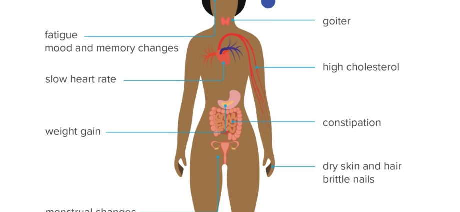 Symptoms of thyroid disease