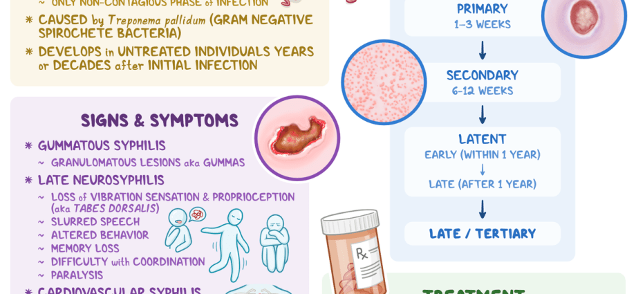 Syphilis (syphilis) &#8211; types, research, causes and treatment. Syphilis symptoms