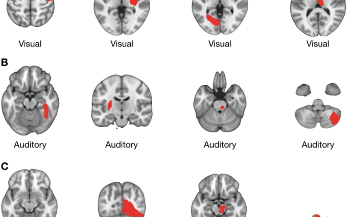 Tactile hallucinosis, a disease of single women