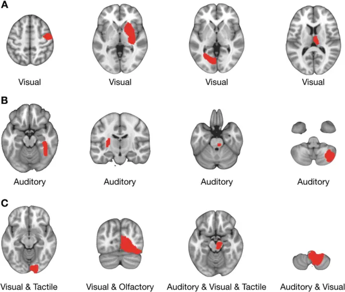 Tactile hallucinosis, a disease of single women