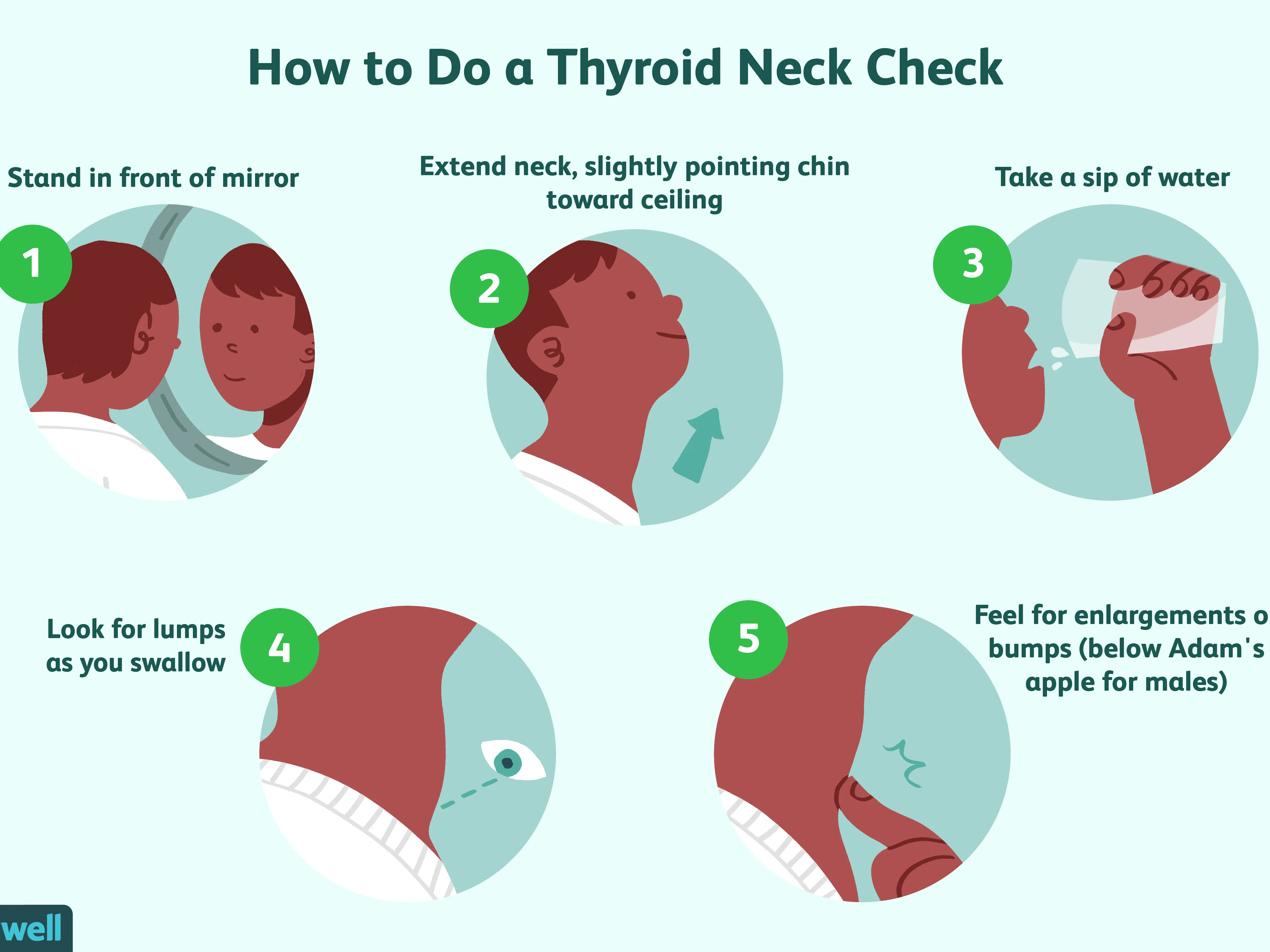 Take a look at the thyroid gland. You will recognize the disease by its appearance