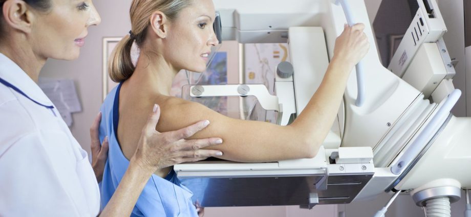 Take care of your health and get a free mammography