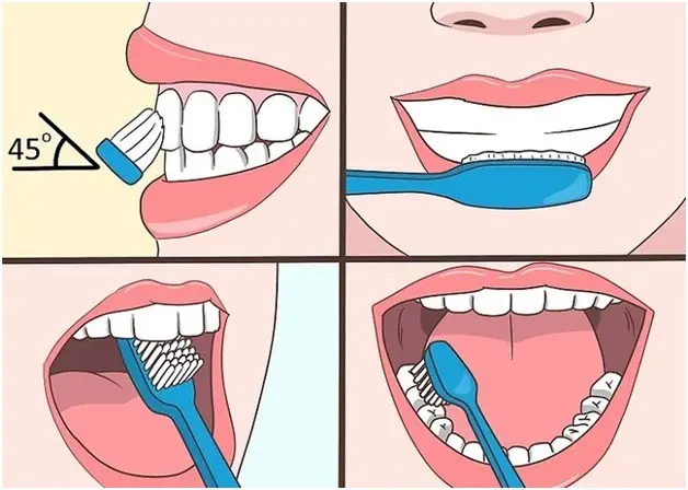 Tartar removal &#8211; home and dental methods