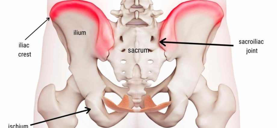 Tears of the right iliac spine