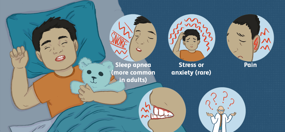 Teeth grinding in a child &#8211; causes, symptoms and treatment