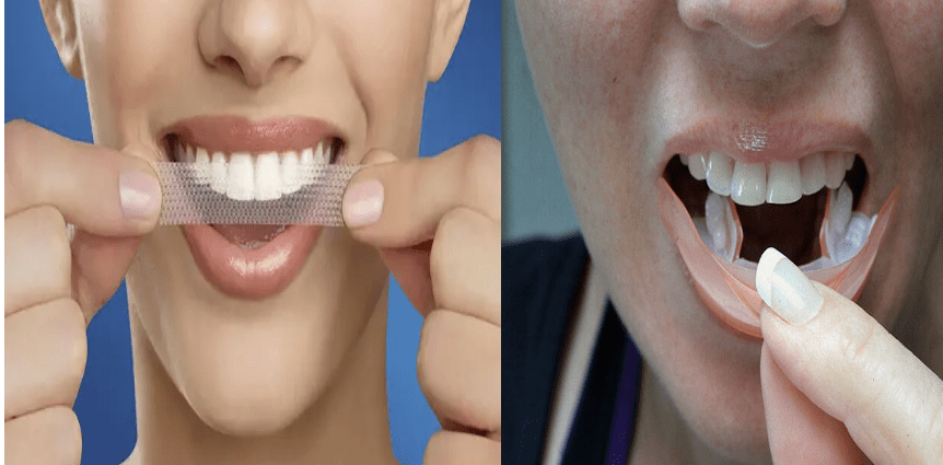 Teeth whitening strips &#8211; action, indications, advantages and disadvantages. Are whitening strips safe?