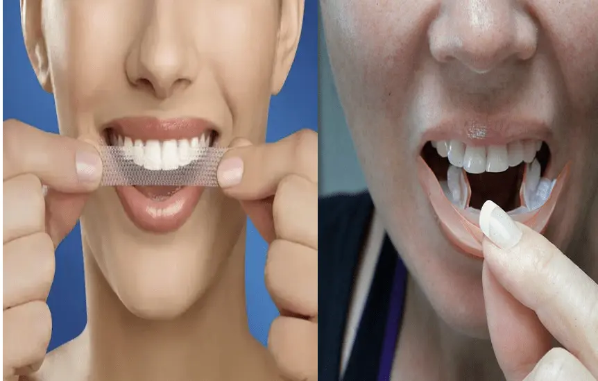 Teeth whitening strips &#8211; action, indications, advantages and disadvantages. Are whitening strips safe?