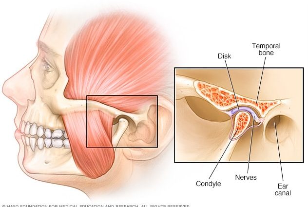 Temporomandibular joint dysfunctions