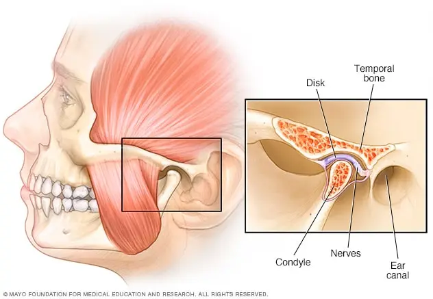 Temporomandibular joint dysfunctions