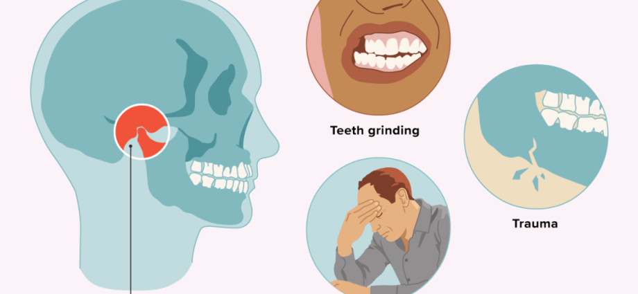 Temporomandibular joint syndrome &#8211; symptoms, causes, treatment