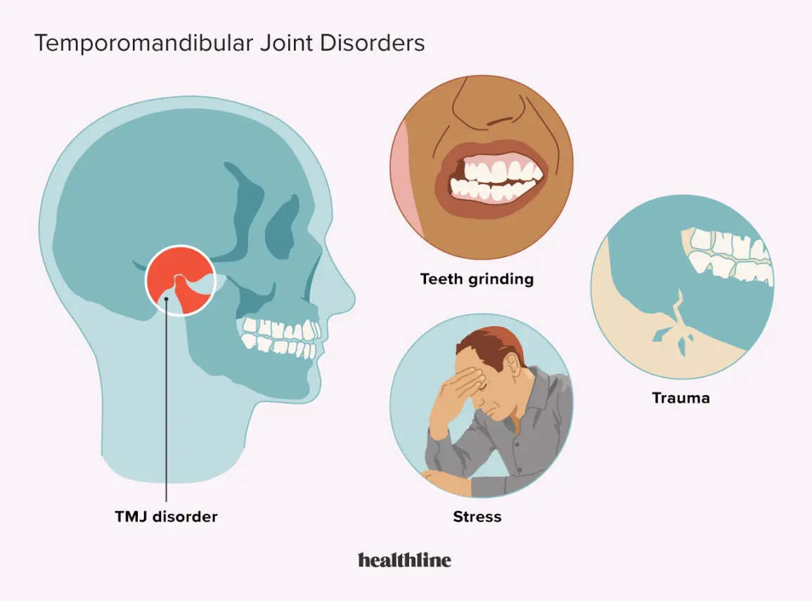 Temporomandibular joint syndrome &#8211; symptoms, causes, treatment