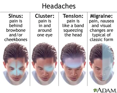 Tension headache