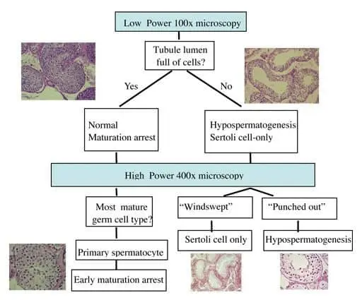 Testicular biopsy and diagnosis of male infertility