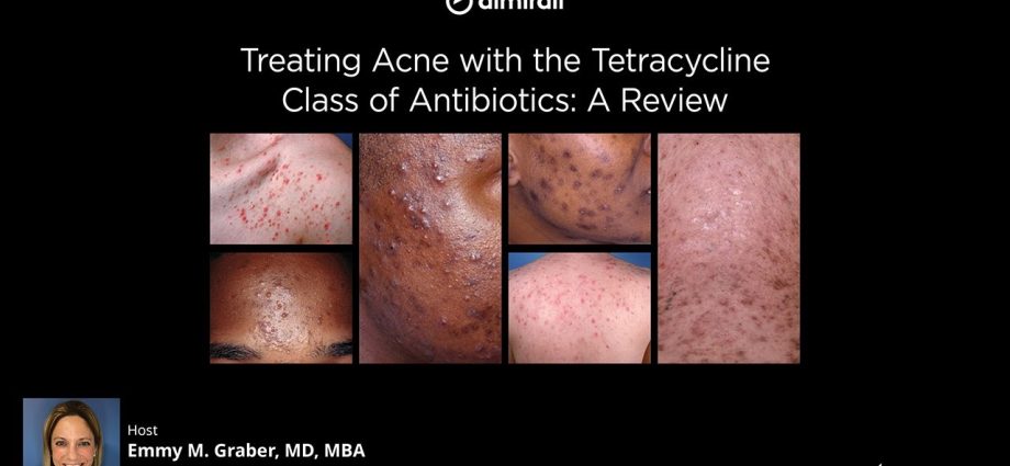 Tetracyclinum TZF &#8211; a drug for common acne. How does tetracycline work?