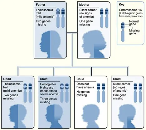 Thalassemia &#8211; why does the disease develop? Forms, symptoms and treatment of thalassemia