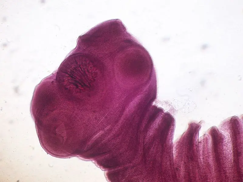 The 10 most dangerous parasites that lurk in food