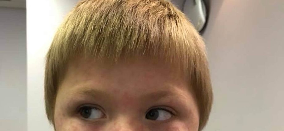 The 5-year-old suffered a rare disease due to a tick. Mother warns other parents