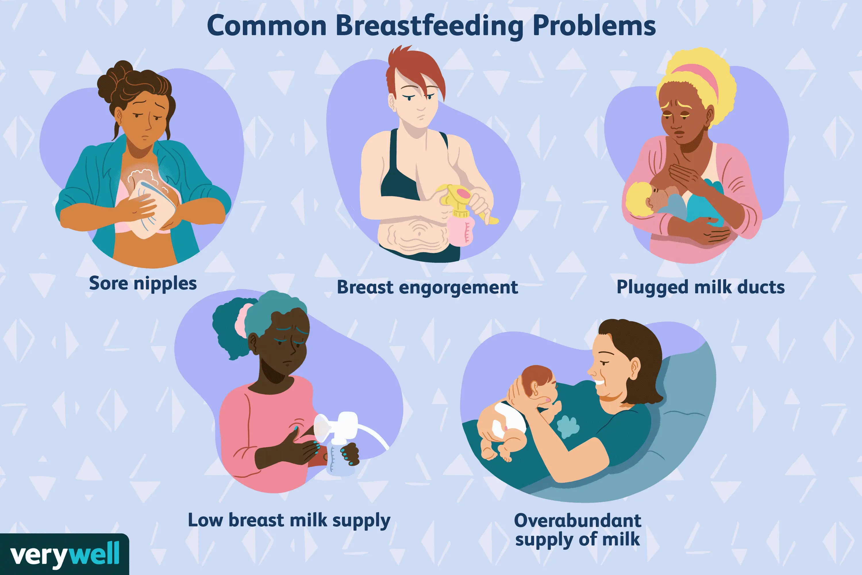 The 7 most common health problems associated with breastfeeding