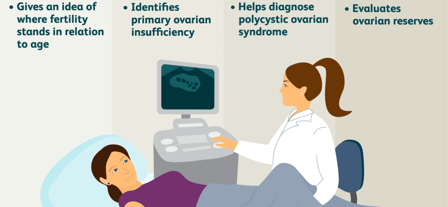 The AFC ultrasound examination in the diagnosis of female infertility &#8211; the most important information