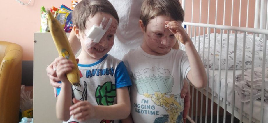 The  bomb took the eyes off the mother with the children. A doctor from Lublin worked a miracle