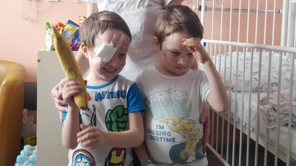 The  bomb took the eyes off the mother with the children. A doctor from Lublin worked a miracle