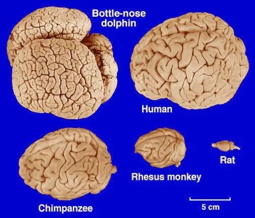 The brain is the most complicated structure in the universe