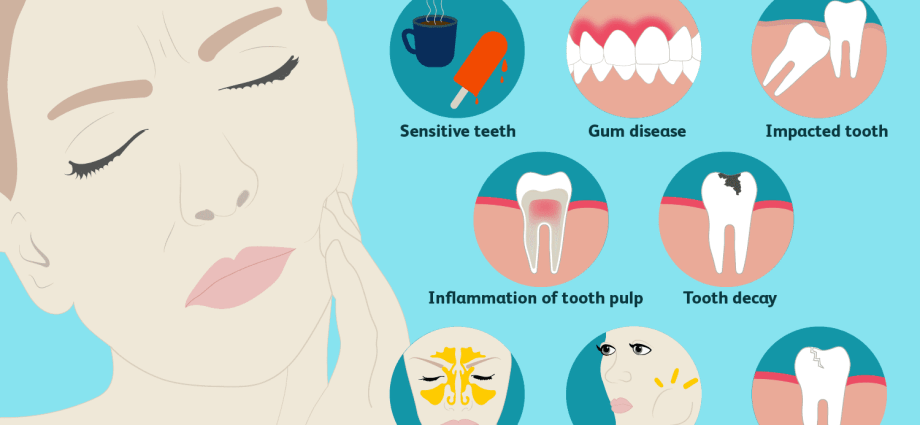 The causes of pain in molars &#8211; diagnosis, treatment