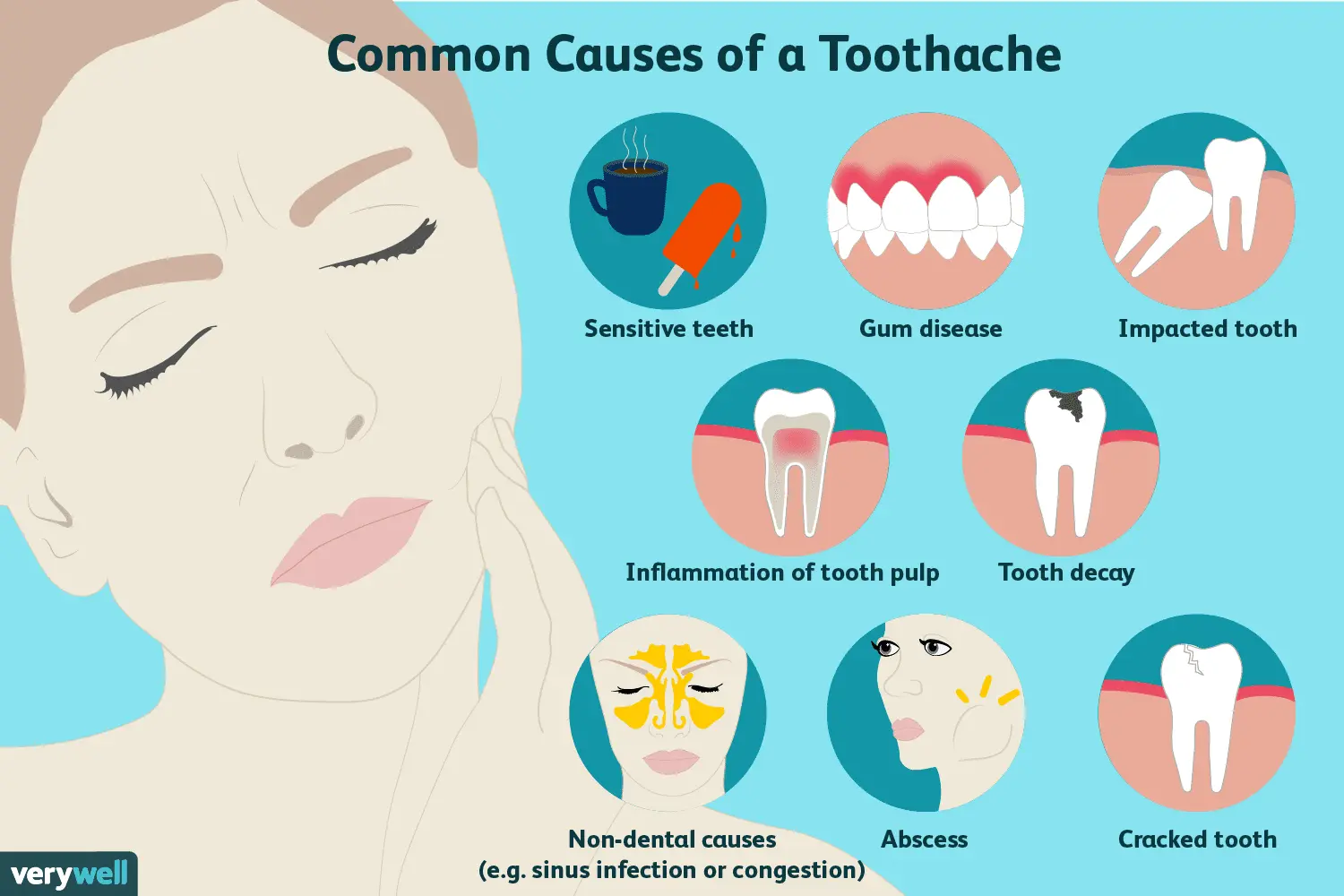 The causes of pain in molars &#8211; diagnosis, treatment