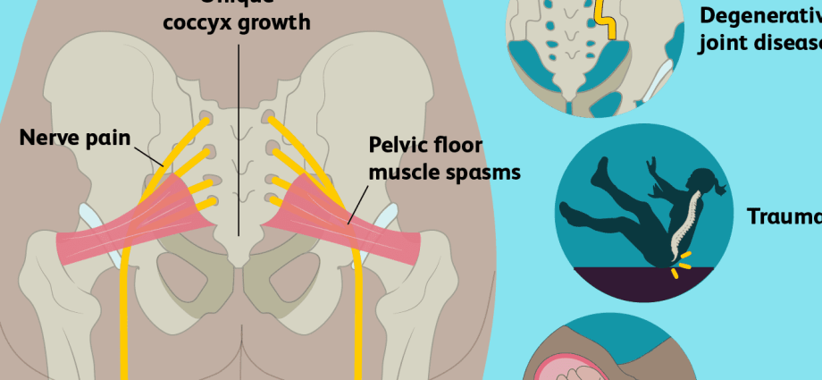 The coccyx &#8211; structure, functions, injuries