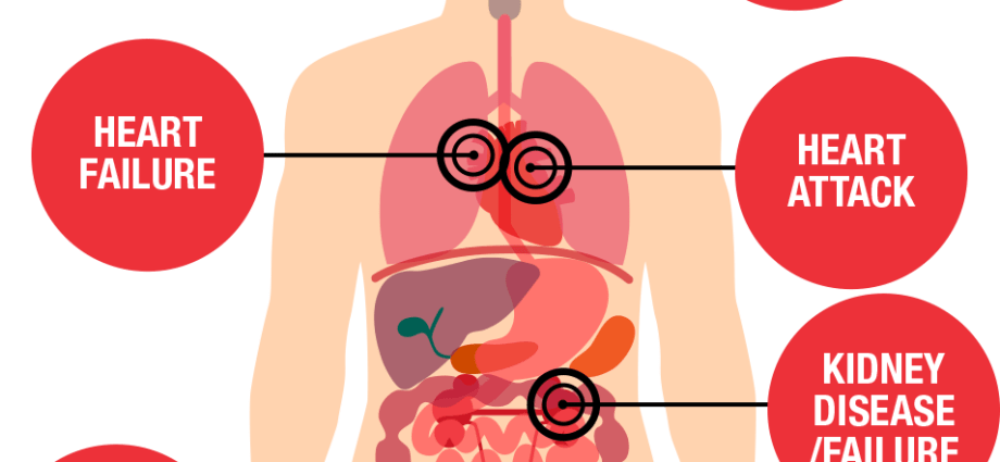 The dangerous effects of hypertension. Four reasons why you should fight high blood pressure