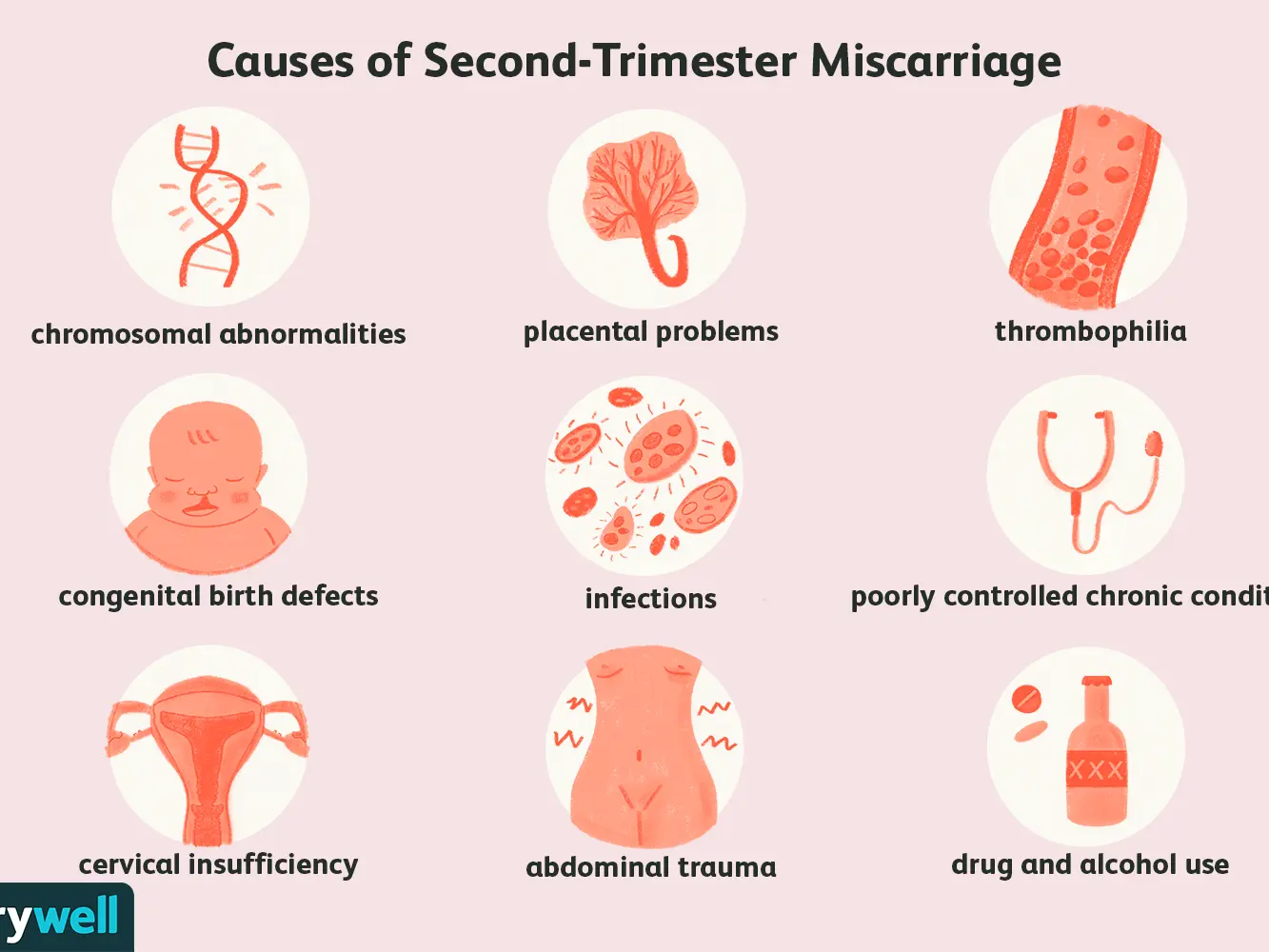 The eight most common causes of miscarriage