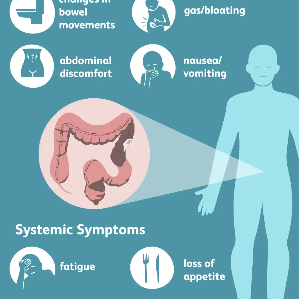 The eight most common symptoms of colon cancer