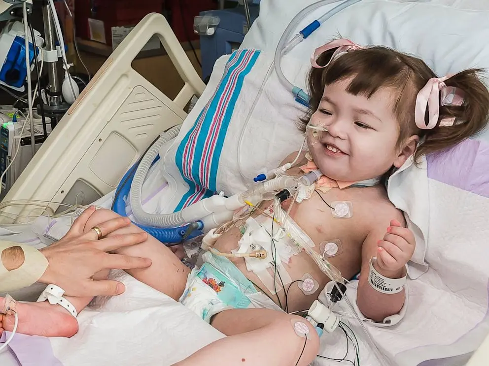 The first child died after an artificial tracheal transplant