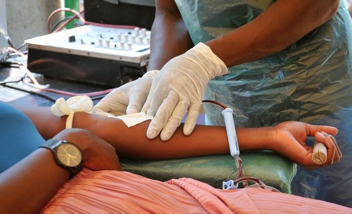 The first cord blood transplant in an AIDS patient