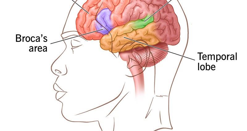 The first symptoms of aphasia. &#8220;The sick themselves notice that something is wrong&#8221;