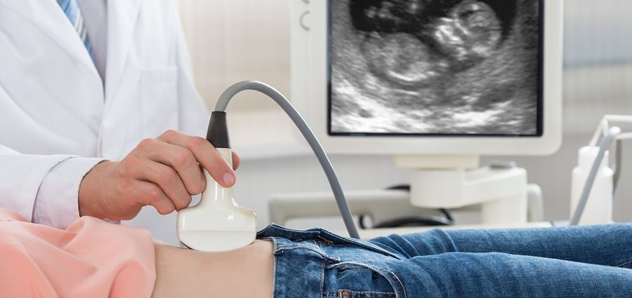 The first ultrasound &#8211; what can I expect?