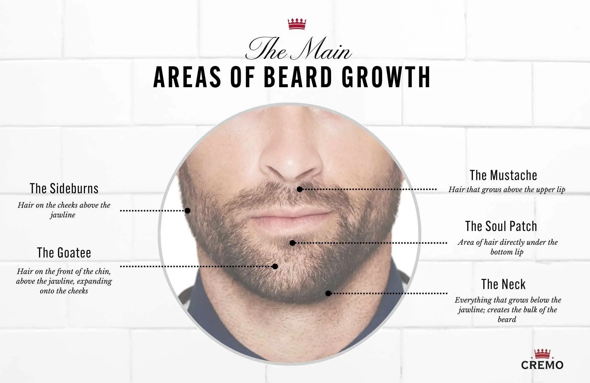 The formation of a &#8220;beard&#8221;: causes and methods of struggle