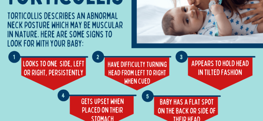 The game console helps to recognize torticollis