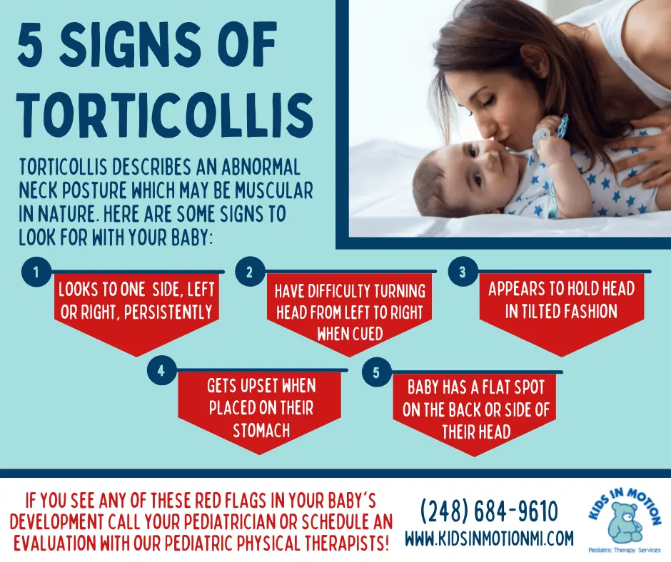 The game console helps to recognize torticollis