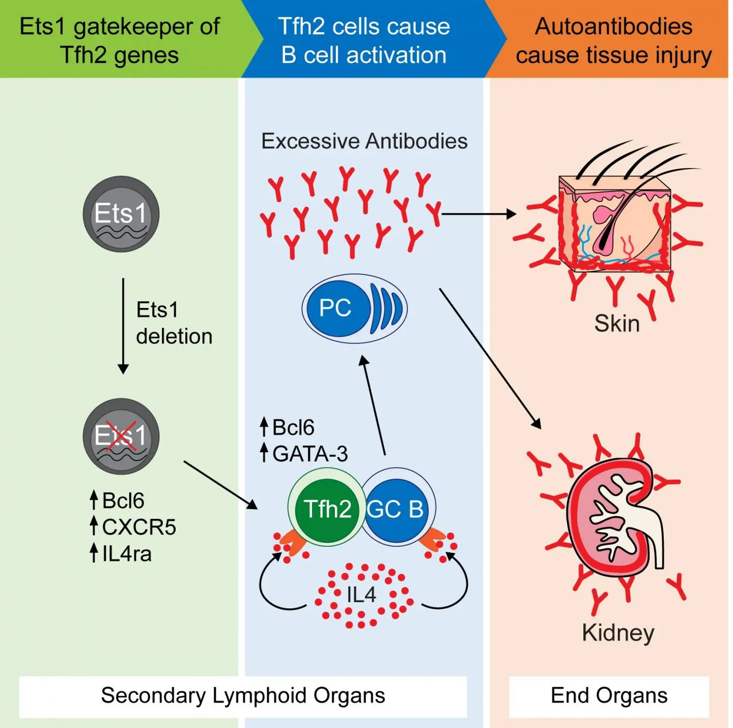 The genes guilty of lupus erythematosus