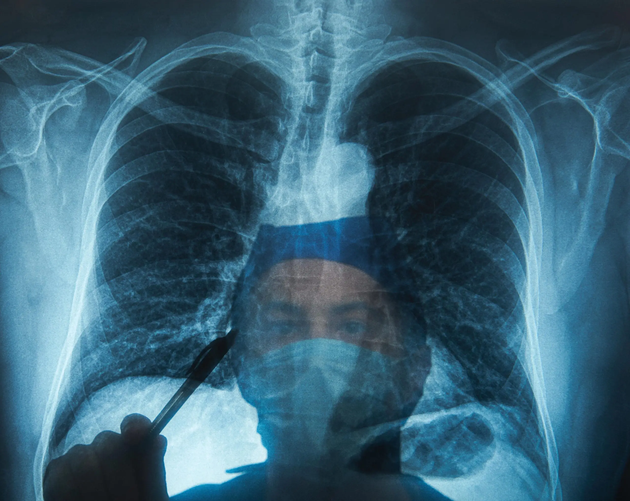 The government ignores lung cancer patients