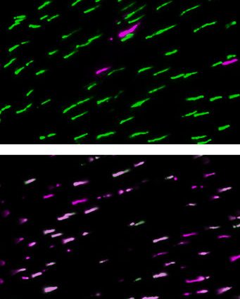 The influence of the thyroid gland on color vision