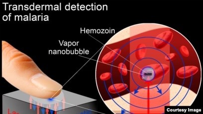 The laser senses the malaria through the skin