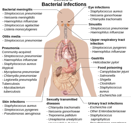 The most common bacterial diseases &#8211; overview and characteristics