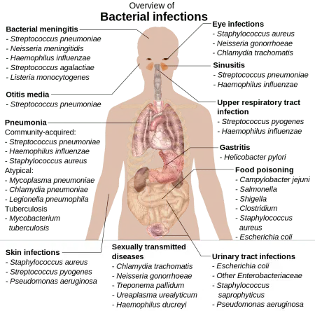 The most common bacterial diseases &#8211; overview and characteristics