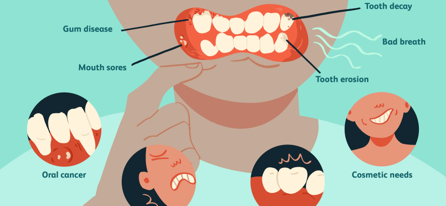 The most common diseases of the teeth and gums