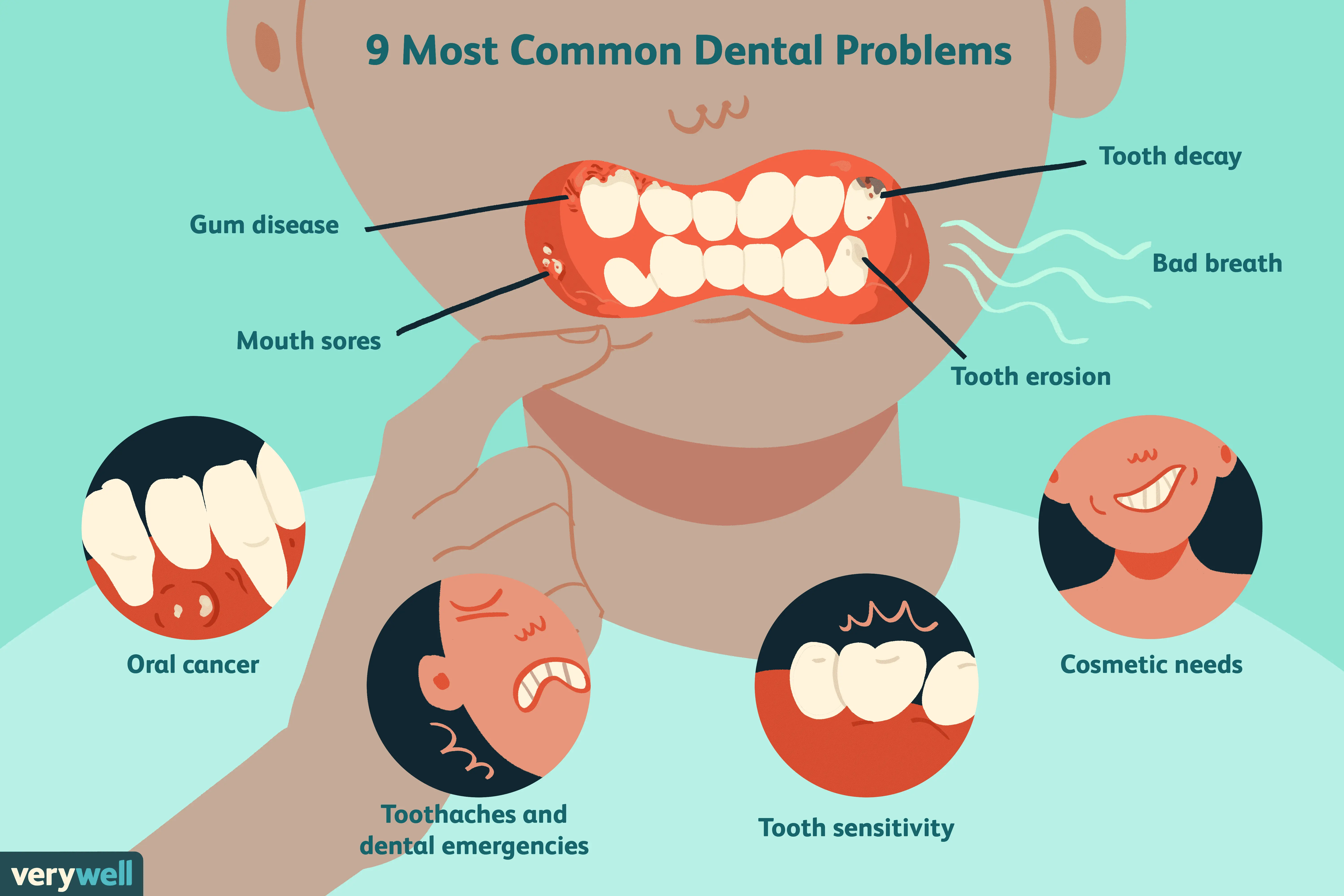 The most common diseases of the teeth and gums