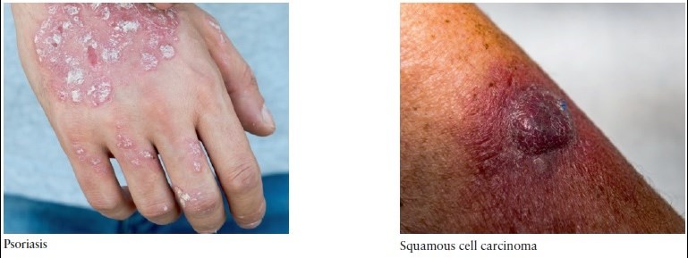 The most common skin problems in the elderly. How to recognize and treat them?